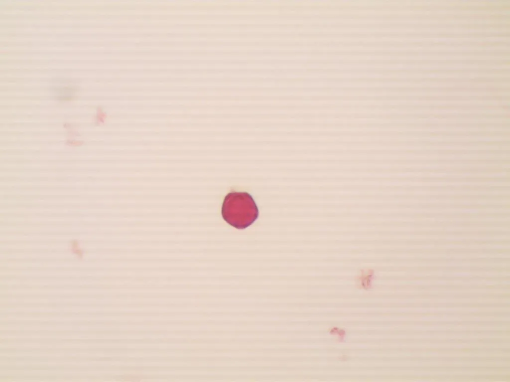 Pollens en suspension: Aulne  