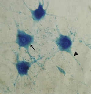 Préparation microscopique : Neurones motrices 