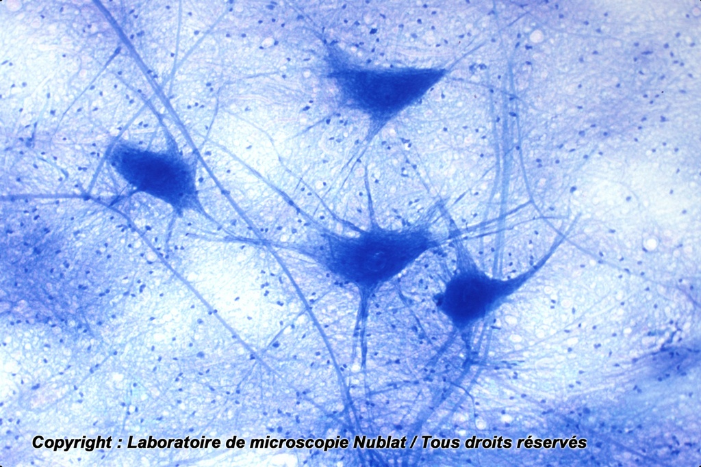 Préparation microscopique Nublat : Cellules nerveuses dissociées, moelle épinière, BM