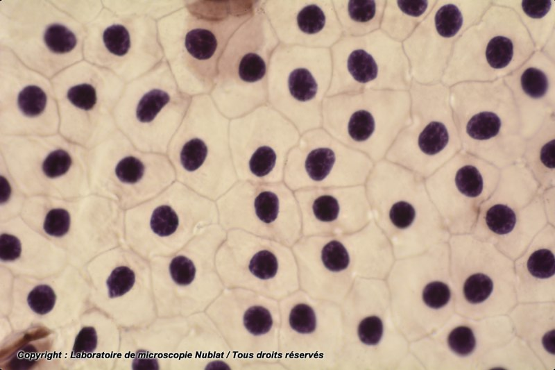 Préparation microscopique Nublat : Mue de triton à plat