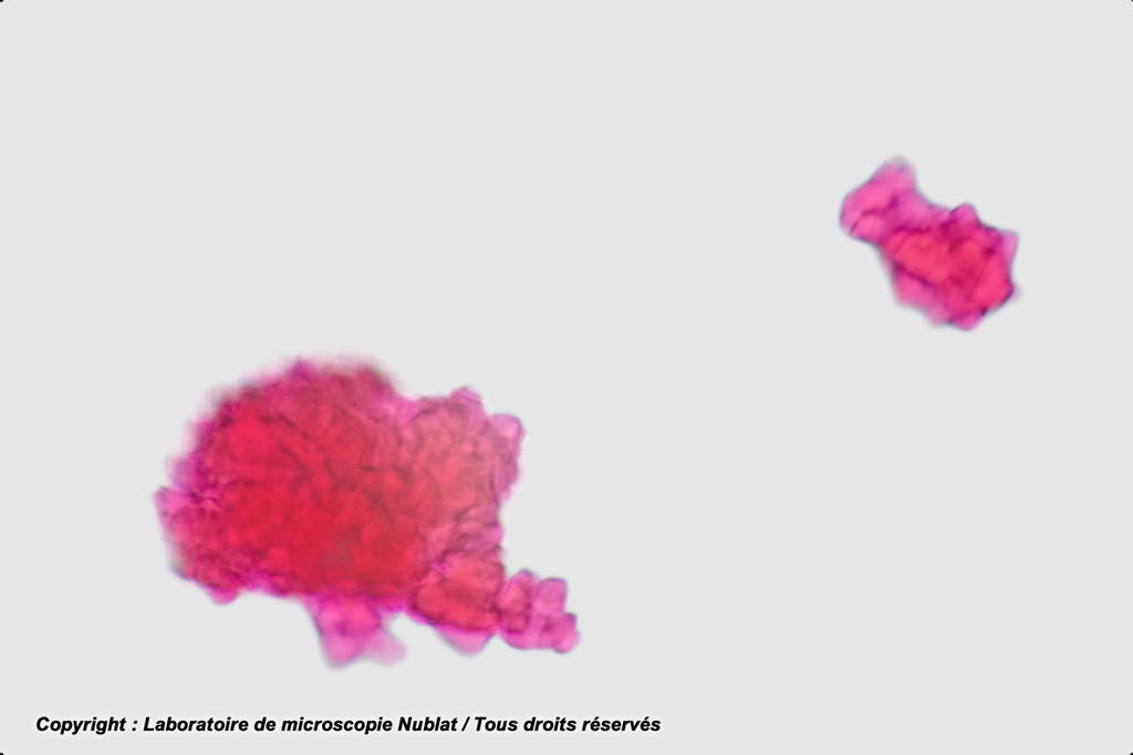 Agglutination d’hématies A par un sérum d’anticorps anti A - Nublat
