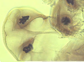 Cytologie et histologie diverses: Chromosome géants chironome