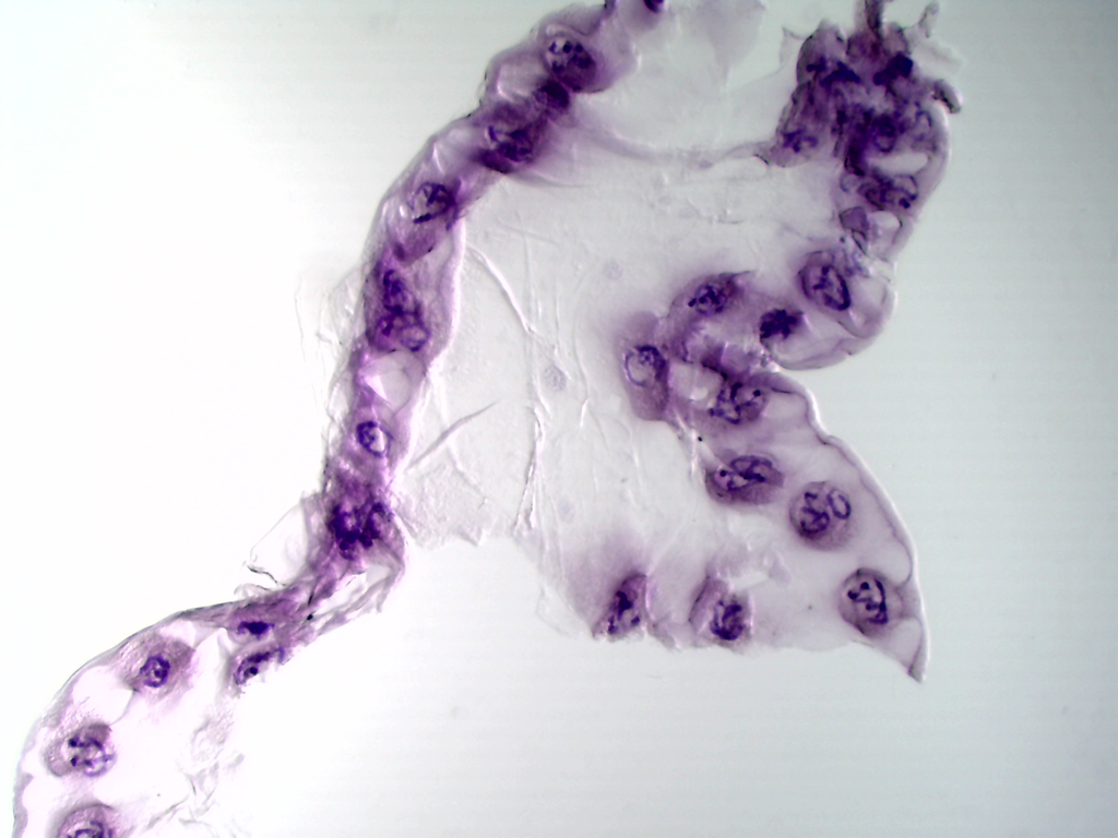Chromosome géants chironome objectif x4