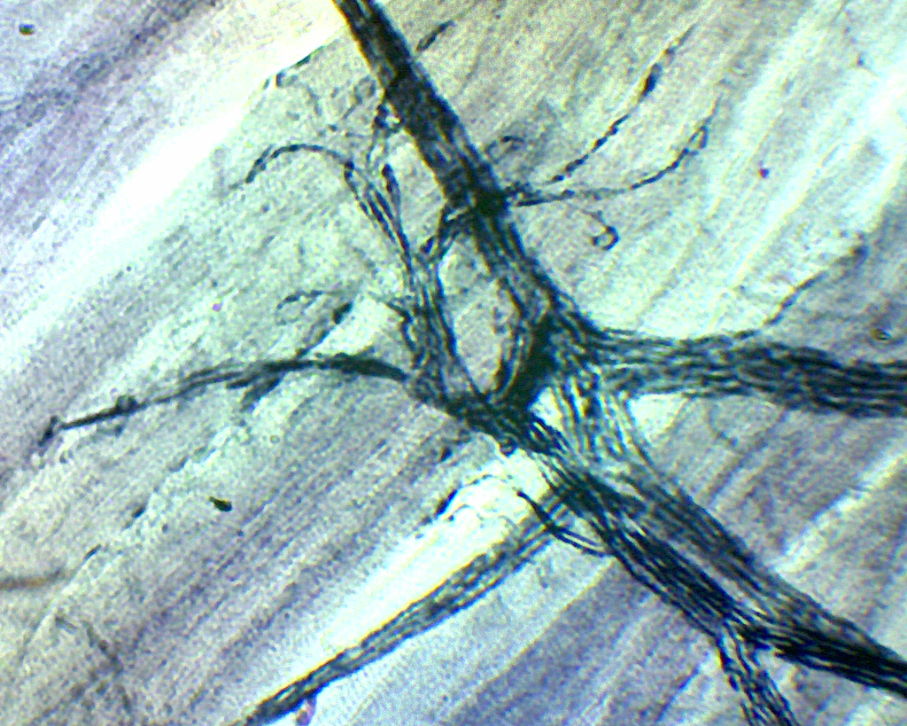Histologie des vertébrés: Cellules nerveuses moelle (rat ou lapin) CT  
