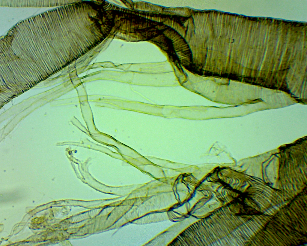 Insectes: Trachée insecte