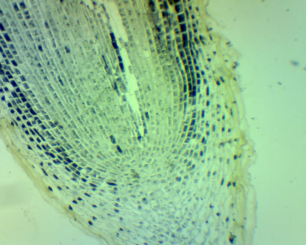 Angiospermes - Cellules et tissus: Mitose végétale racine jacinthe - CL