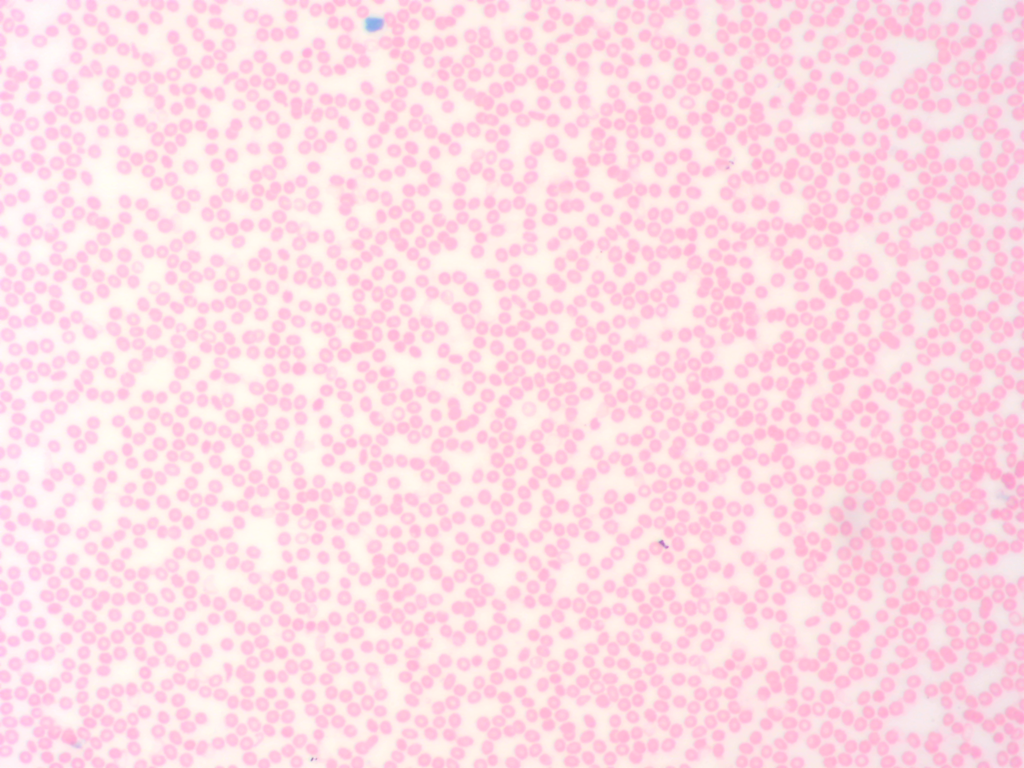 Histologie des vertébrés: Sang humain giemsa