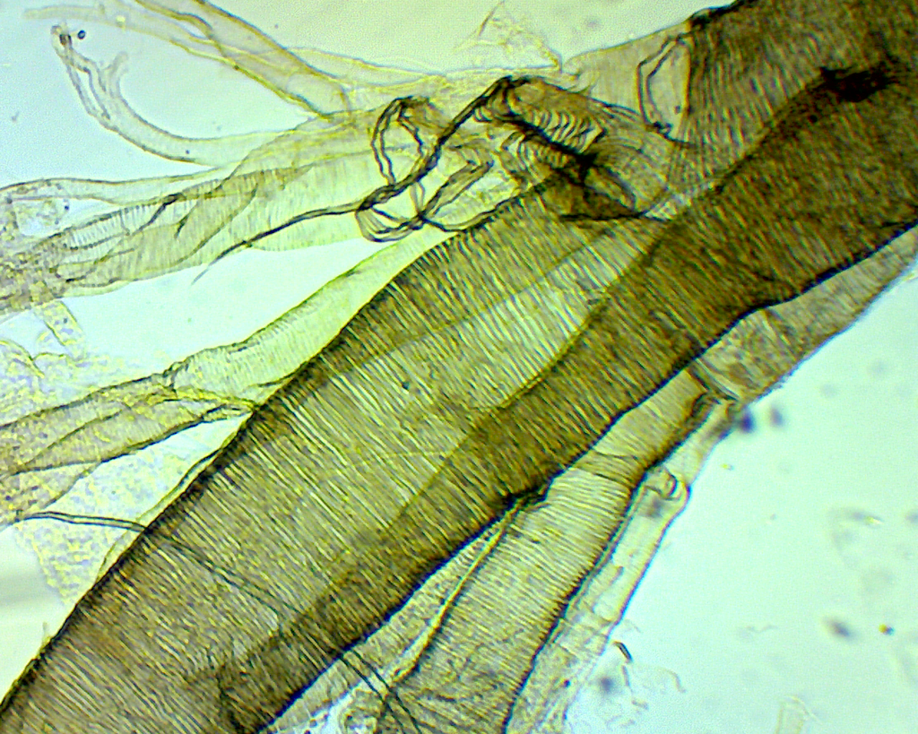 [#027005-S60637] Insectes: Trachée insecte