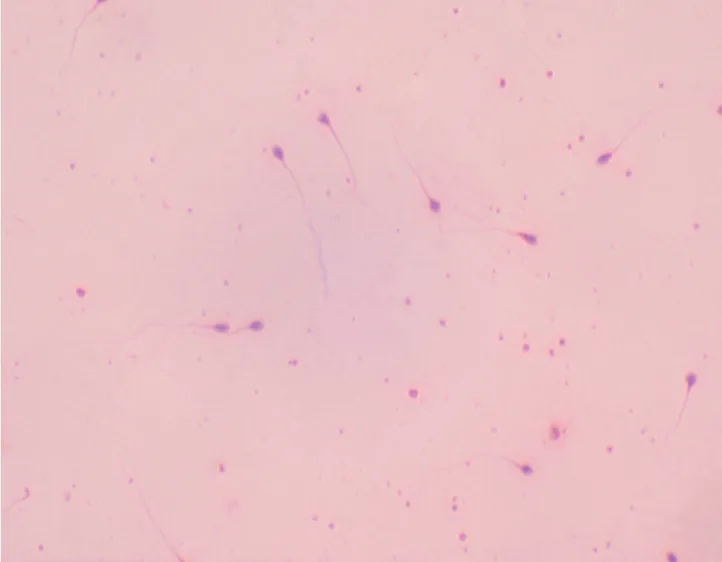 Histologie des vertébrés: Sperme humain - frottis - Giemsa 