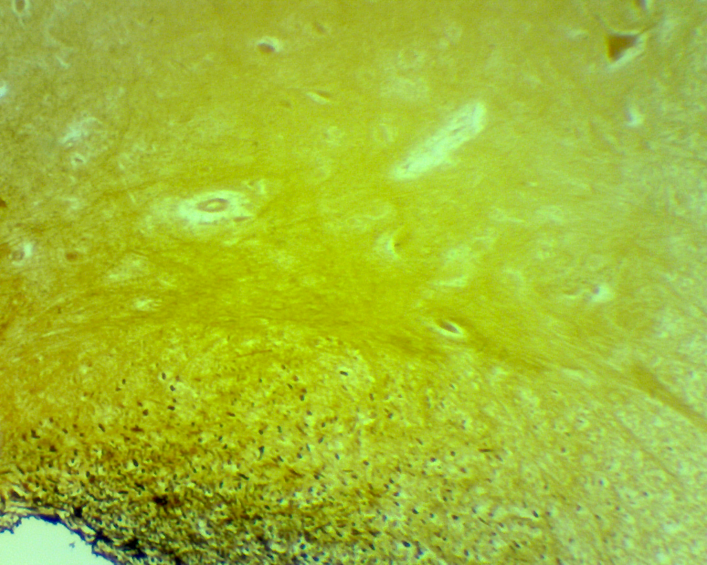 Histologie des vertébrés: Moelle épinière - Lapin CT  