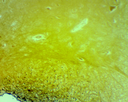 Histologie des vertébrés: Moelle épinière - Lapin CT  