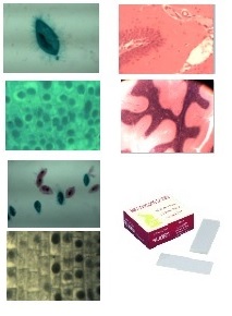 Angiospermes - Cellules et tissus: ADN-ARN (vert de methyle-pyronine sur racine oignon)