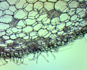 Angiospermes - Racines: Racine - Poils absorbants CT