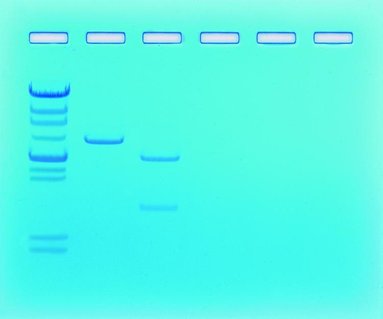 ** Kit de TP - Détermination de la taille de fragments d'ADN pour 6 groupes 