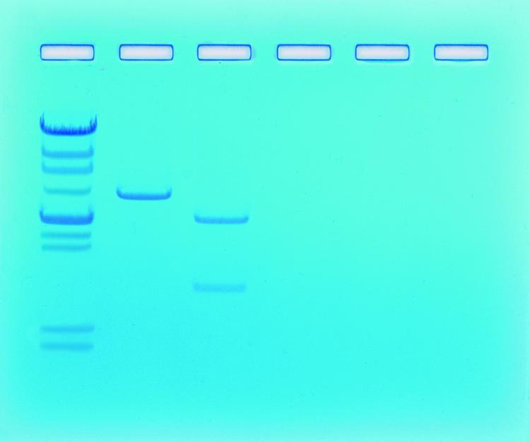 Kit de TP - Détermination de la taille de fragments d'ADN pour 6 groupes 