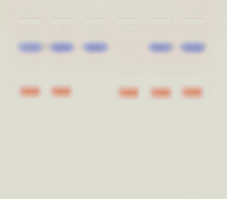 ** Kit de TP - Pourquoi les personnes sont différentes physiquement?