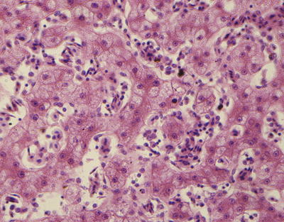 Préparation microscopique : Foie de grenouille