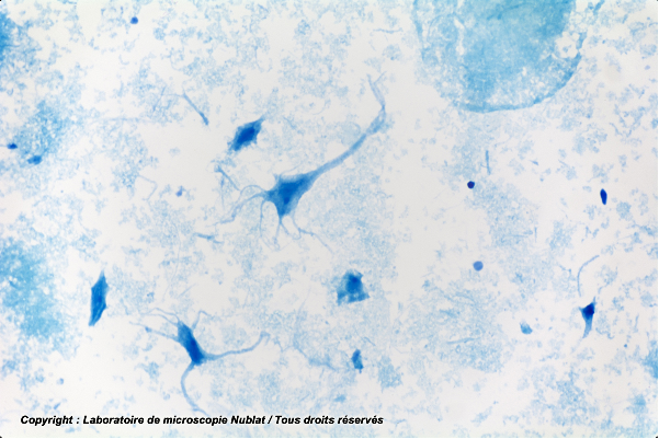 Neurones dissociés, frottis cerveau, BM - NUBLAT