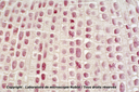 Mitoses - méristème racinaire terminal - Jacinthe - CL - F - Nublat