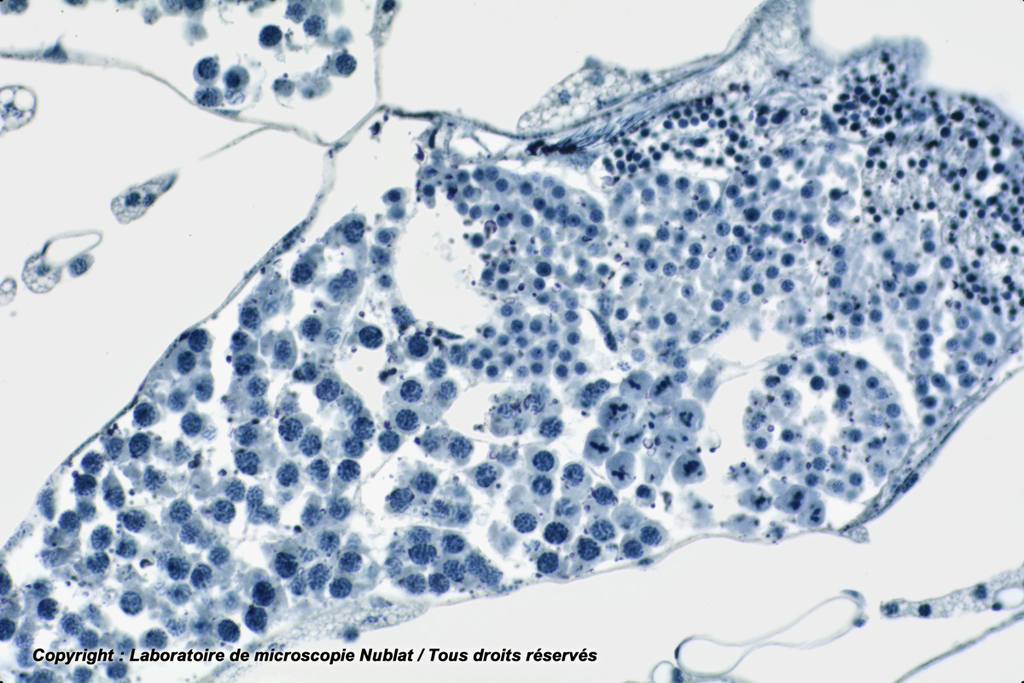 Méiose - testicule Criquet - Nublat