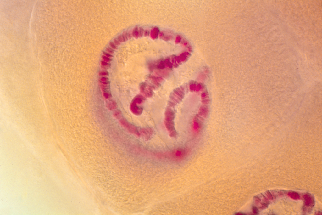 Chromosomes géants - glandes salivaires - larve Chironome - Nublat