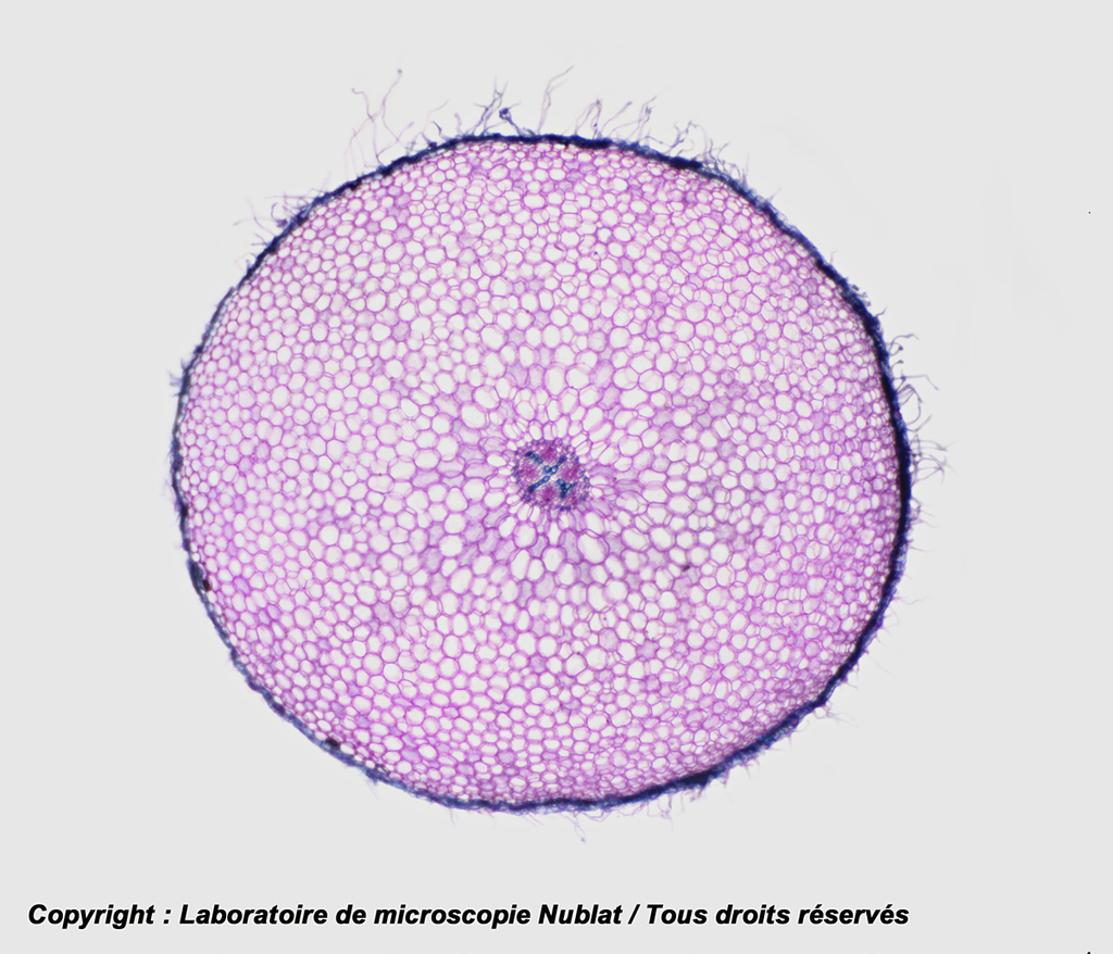 [027802] Poils absorbants CL - sur racine CT - CV - Nublat