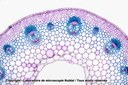 Tige de dicotylédone - structure primaire - Renoncule - CT - CV - Nublat