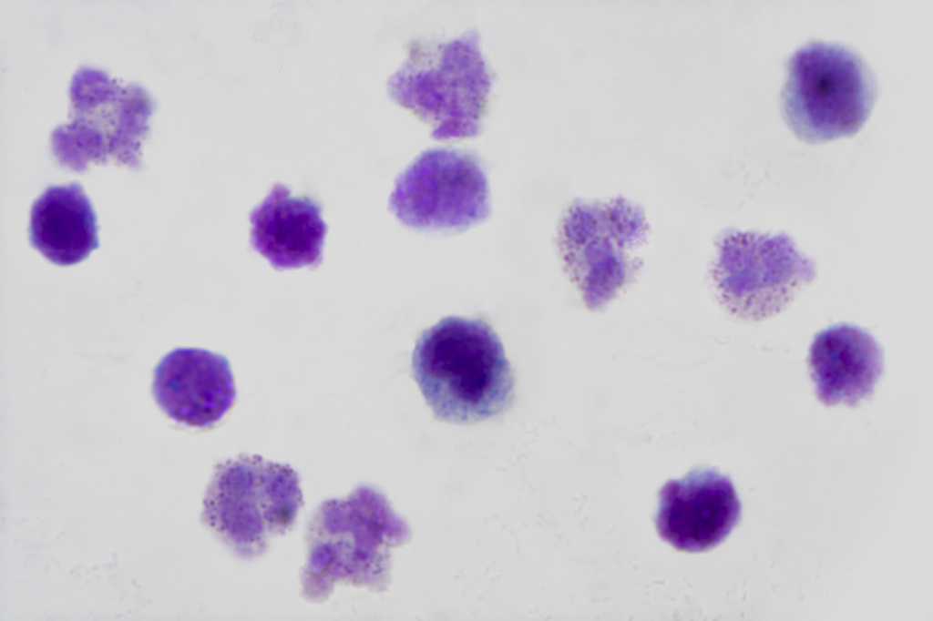 Globules blancs humains : culture pure - frottis  - Nublat