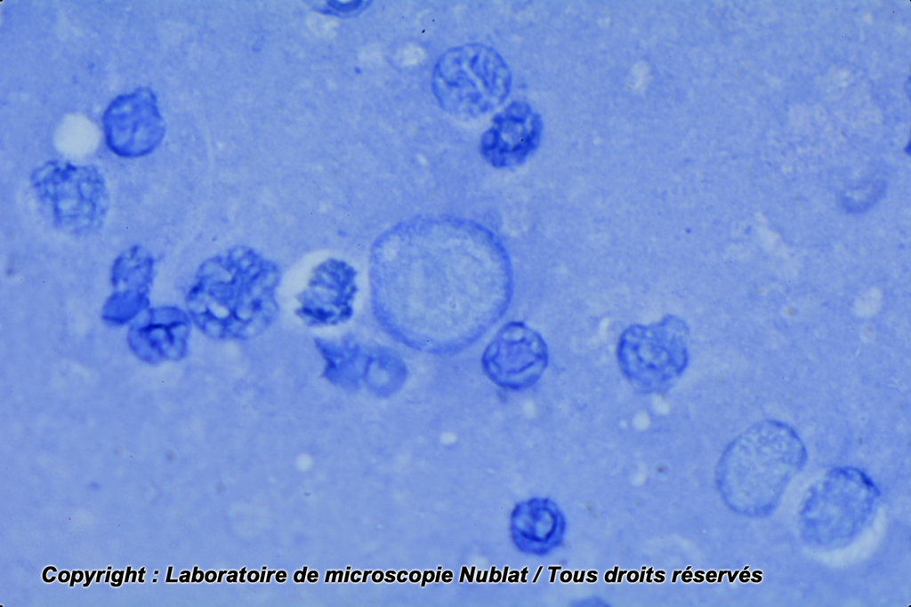 [027582] Macrophages - frottis liquide péritonéal - Nublat