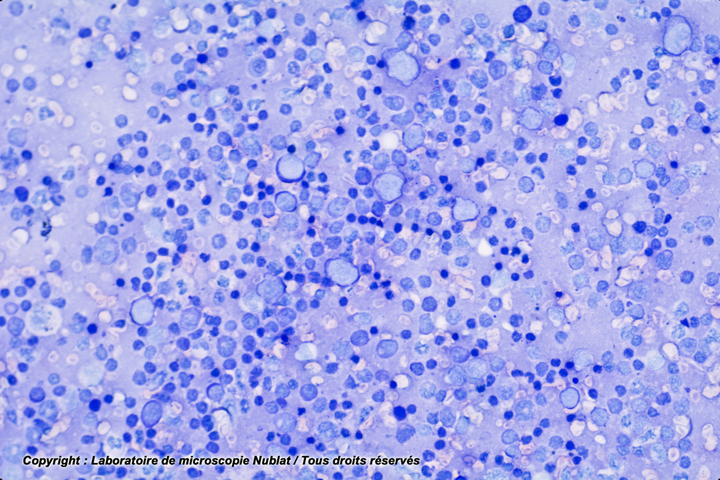 Frottis de rate : lymphocytes - macrophages et plasmocytes - Nublat