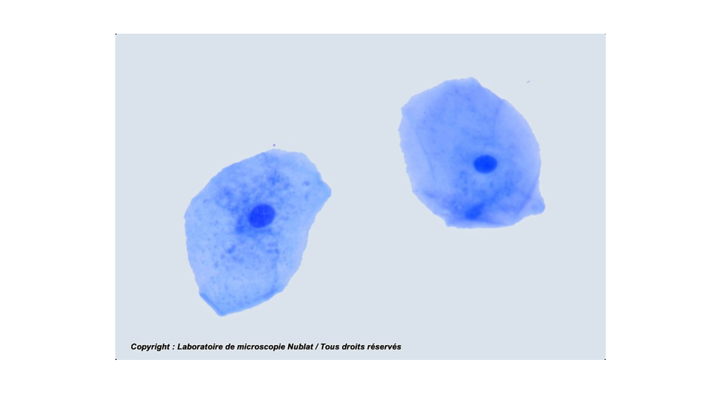 Cellules épithéliales pavimenteuses - buccales - Nublat
