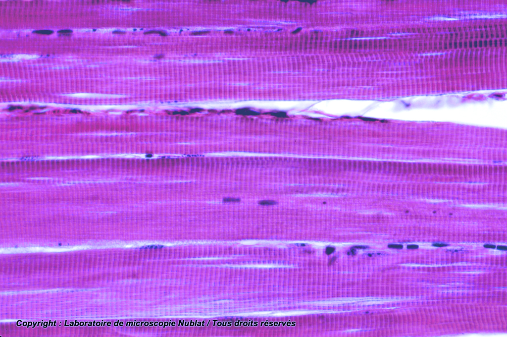 Muscle strié  - CL - HE - Nublat