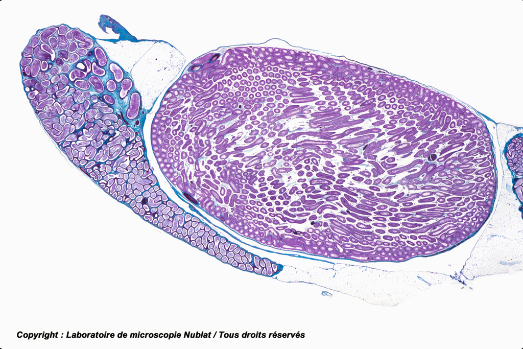 Testicule - Rat - cellules interstitielles - avec épididyme - Nublat