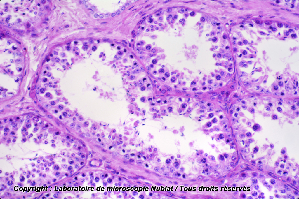 Testicule - Homme - Nublat