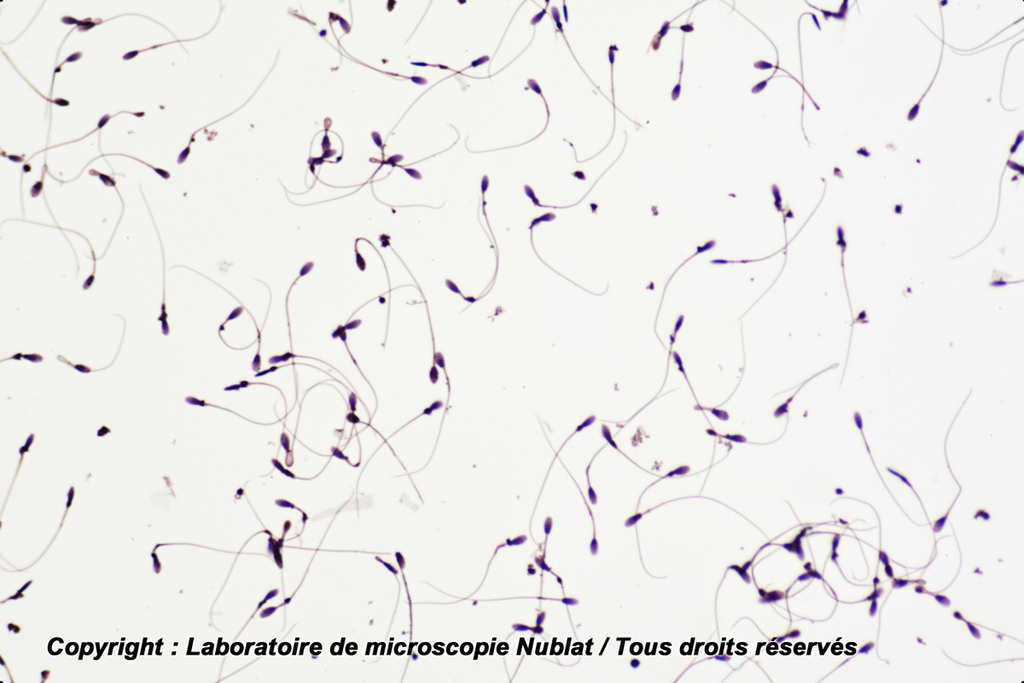 Spermatozoïdes Homme - H - Nublat