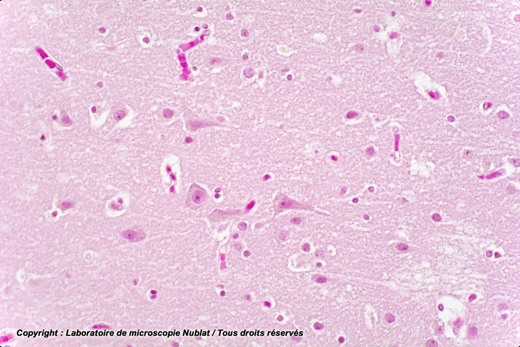 Cerveau - Homme - Nublat