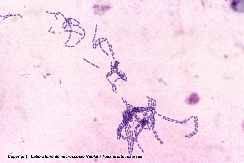 Streptocoques - Nublat