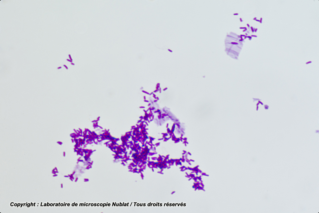 [027924] Escherichia coli - Nublat