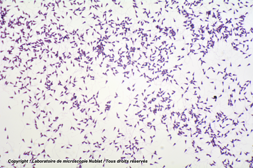 Spermatozoïdes d’Oursin - Nublat