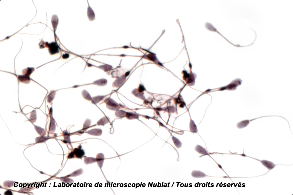 Spermatozoïdes - Taureau - Nublat