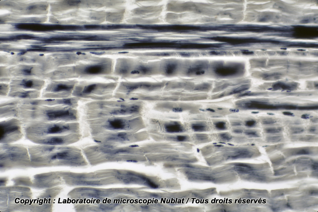 Muscle strié pour les stries - Nublat