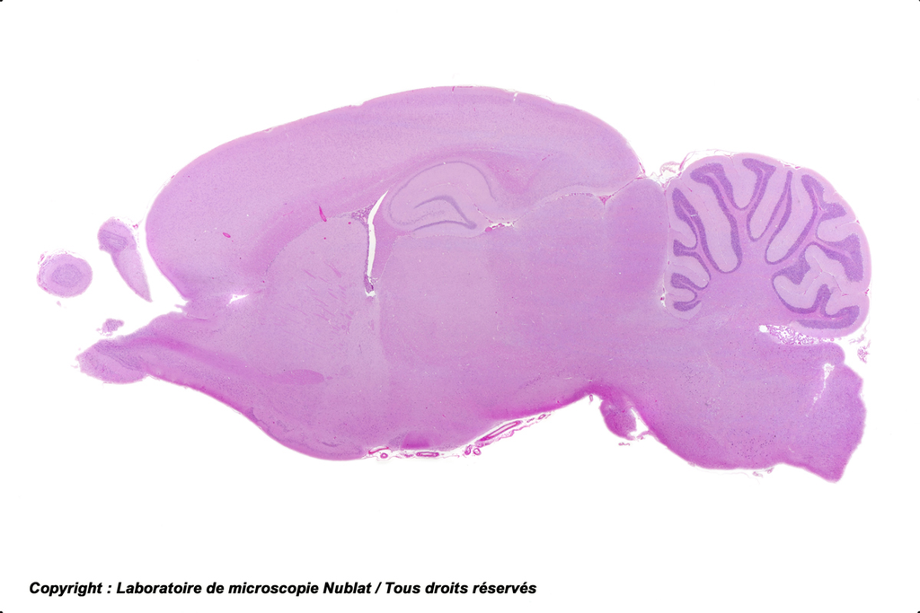 Encéphale total - Nublat