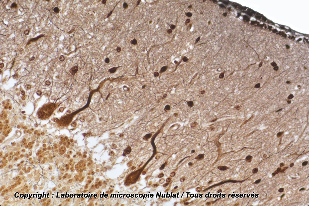 Cellules nerveuses, Cellule Purkinge, cervelet CJ - Nublat
