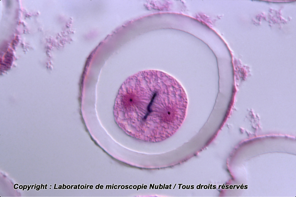 [027505] Mitose - Ascaris - Nublat