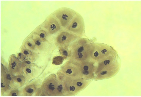[027003-S01086] Cytologie et histologie diverses: Chromosome géants chironome