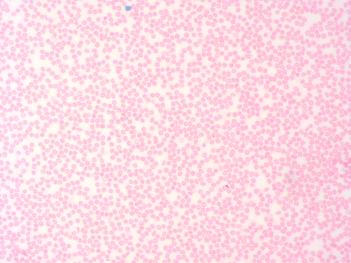 [027004-S60405] Histologie des vertébrés: Sang humain giemsa