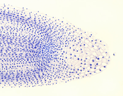[027186] Angiospermes - Cellules et tissus: Mitose végétale racine oignons - CL
