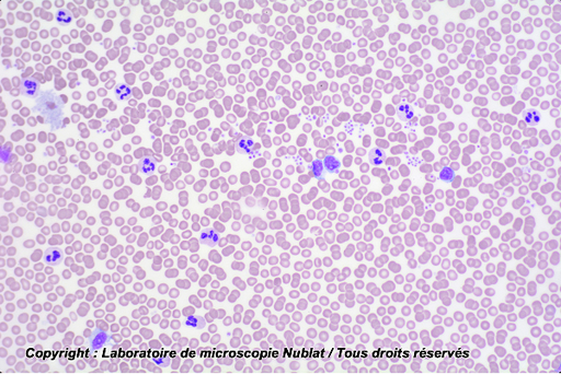 [027387] Préparation microscopique Nublat : Pathologie - Sang humain - septicémie 