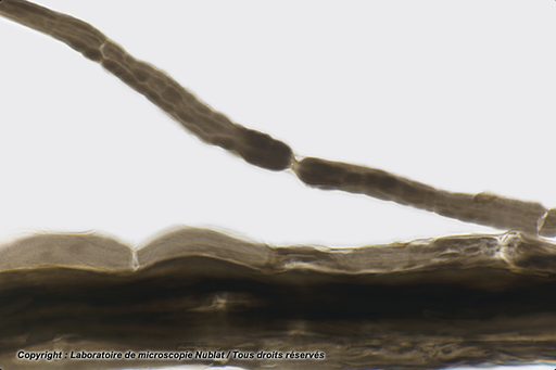 [027430] Préparation microscopique Nublat : Nœuds de Ranvier - Fibres nerveuses dissociées AO